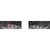 Повязка на голову KV+ TORNADO thumbnail 1